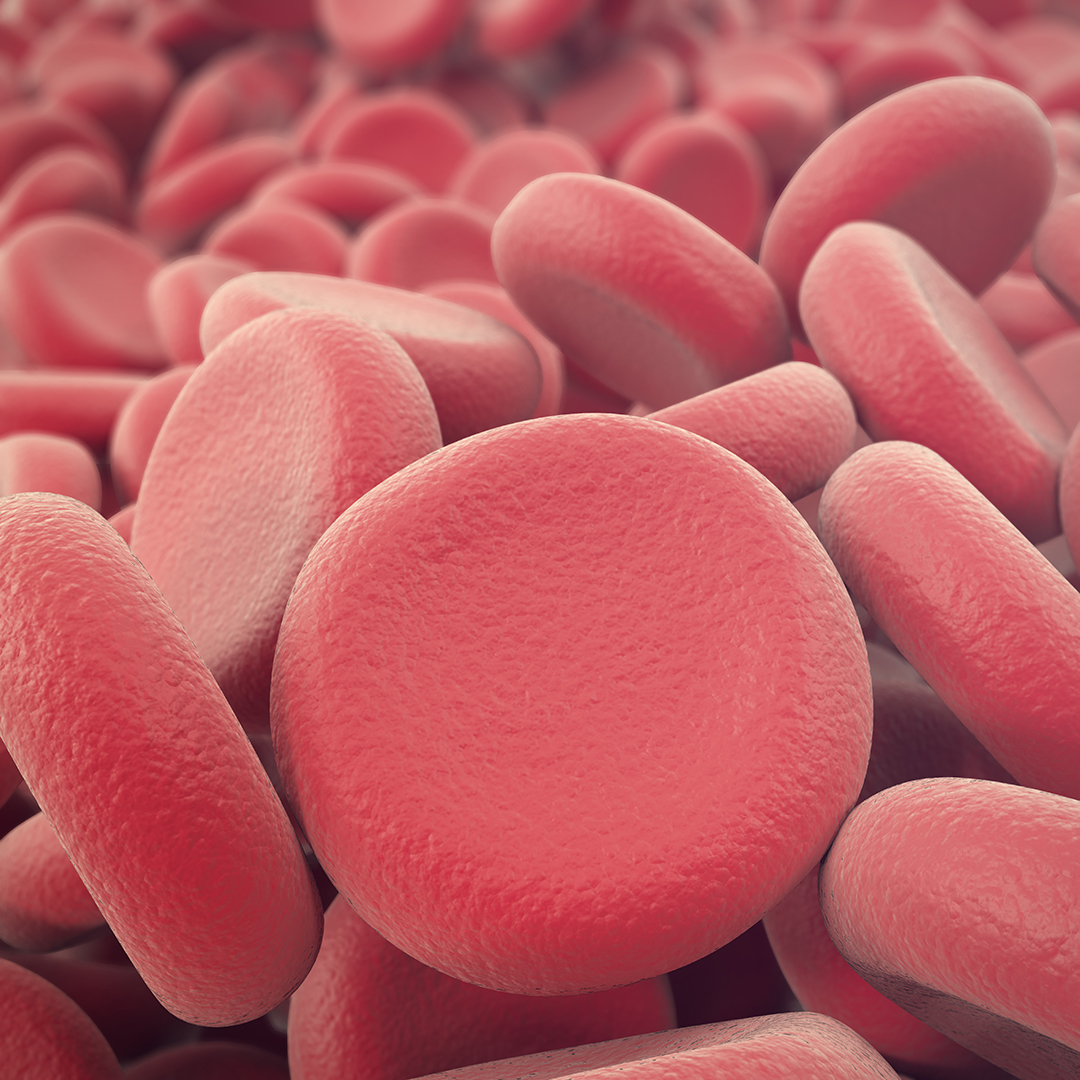 anemia deficit hierro