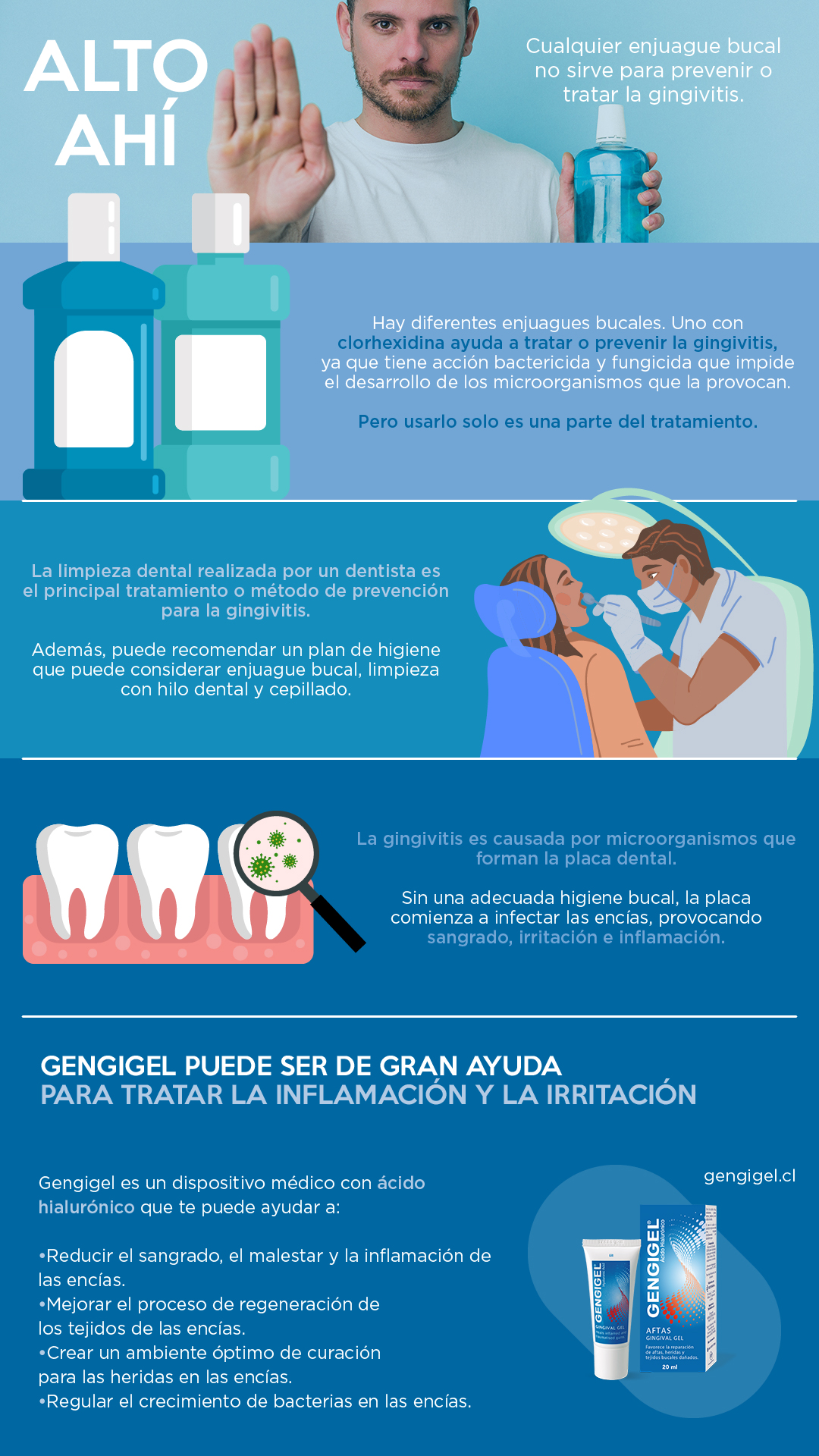 enjuague bucal para gingivitis resumen