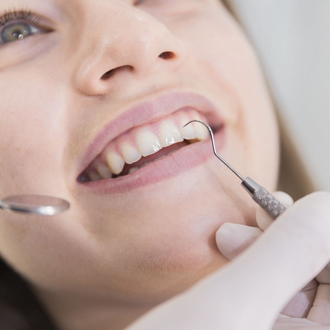 gingivitis
