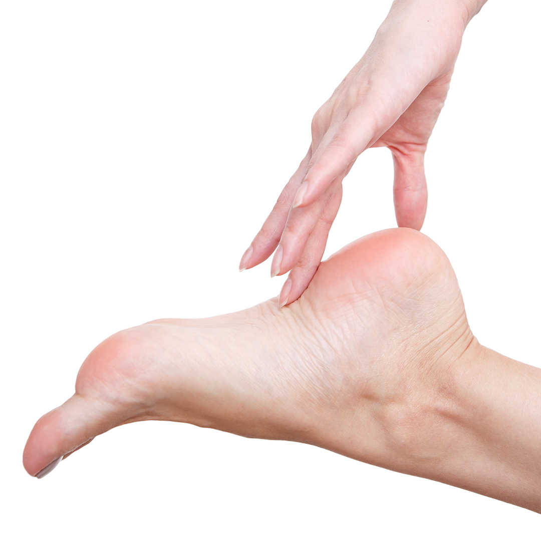 hiperqueratosis qué es