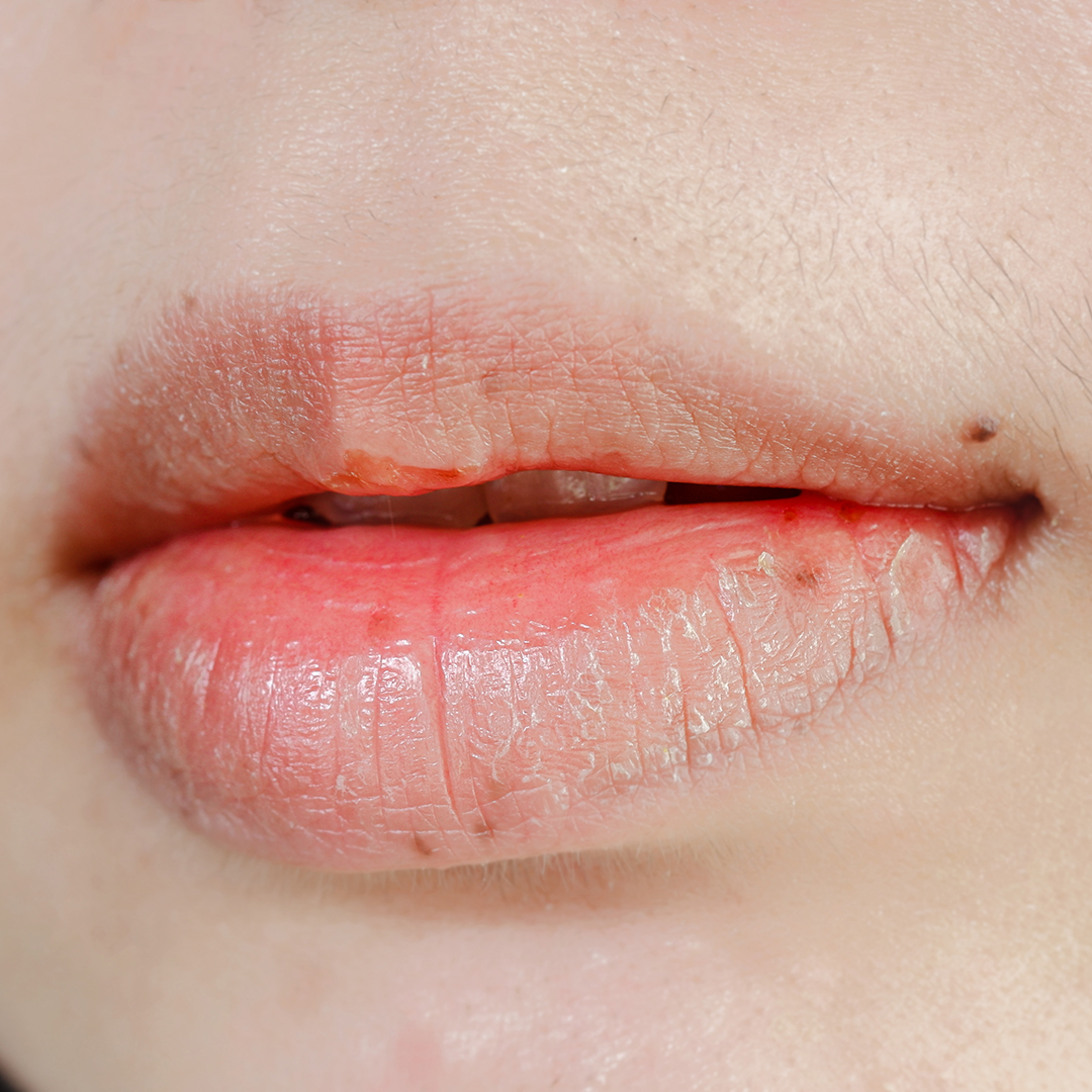 qué importancia tiene la saliva para la salud bucal hidrata y lubrica