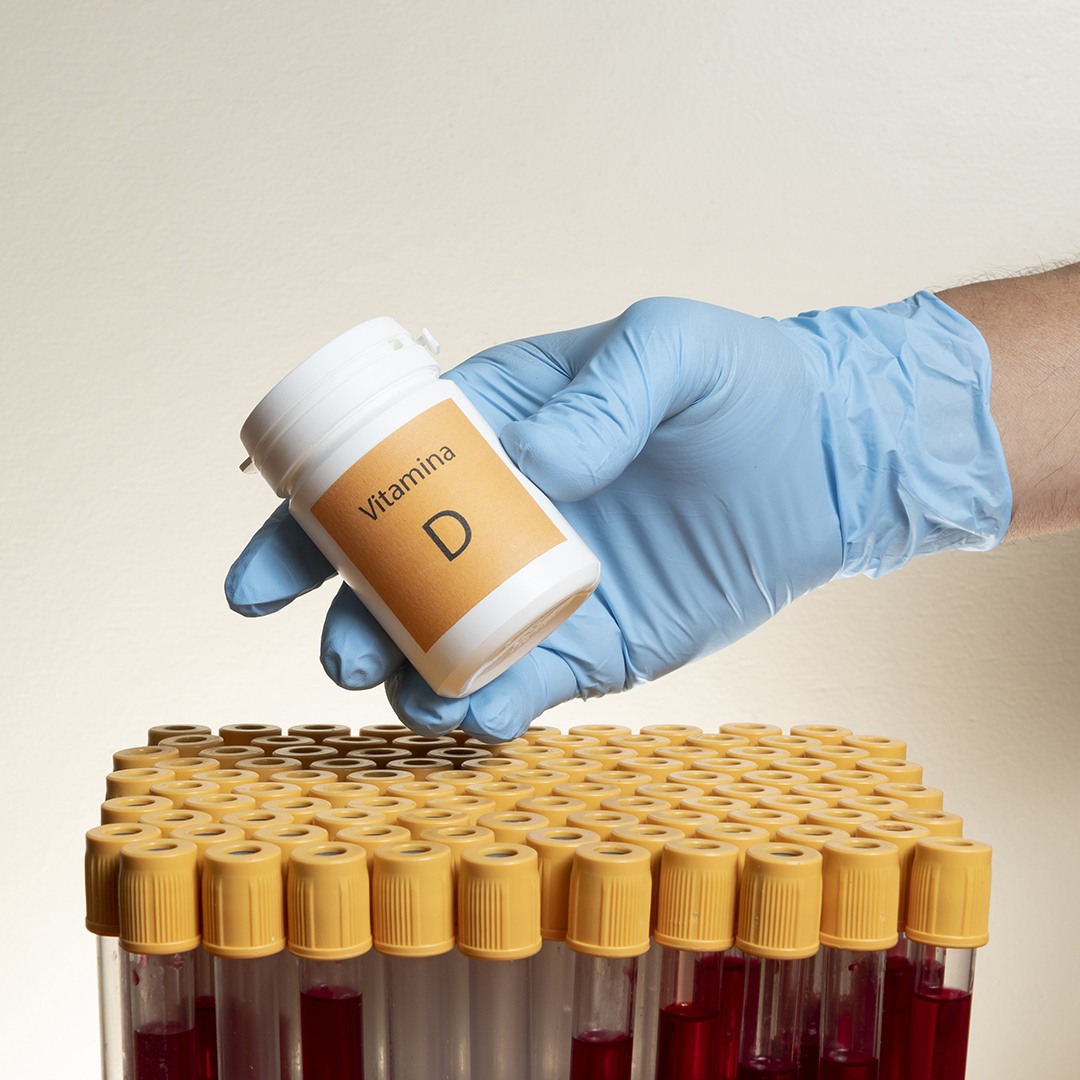vitamina d encías estudio gingivitis