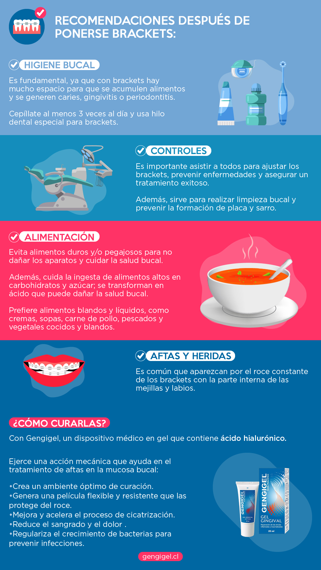recomendaciones después de ponerse brackets resumen