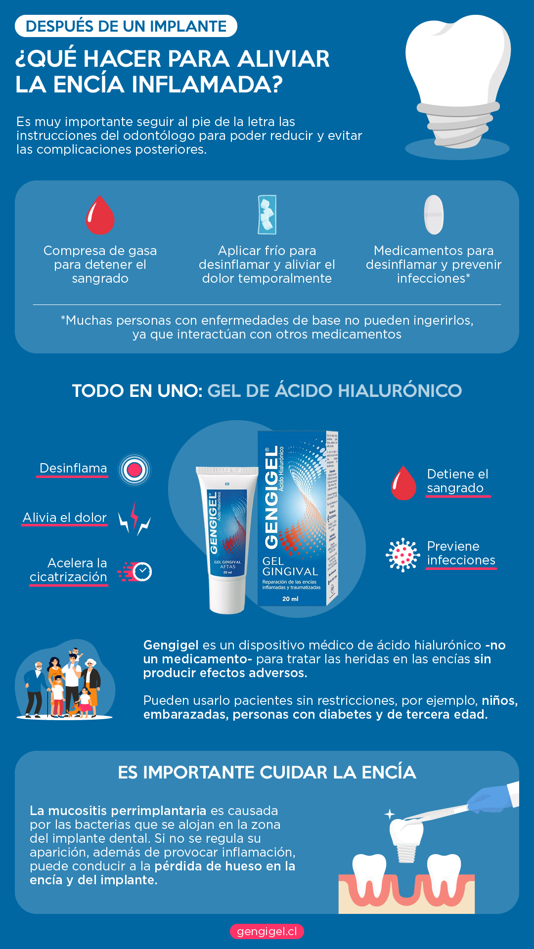 encía inflamada implante dental resumen