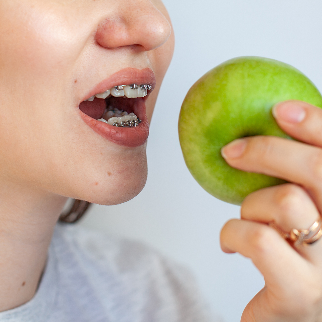 alimentación