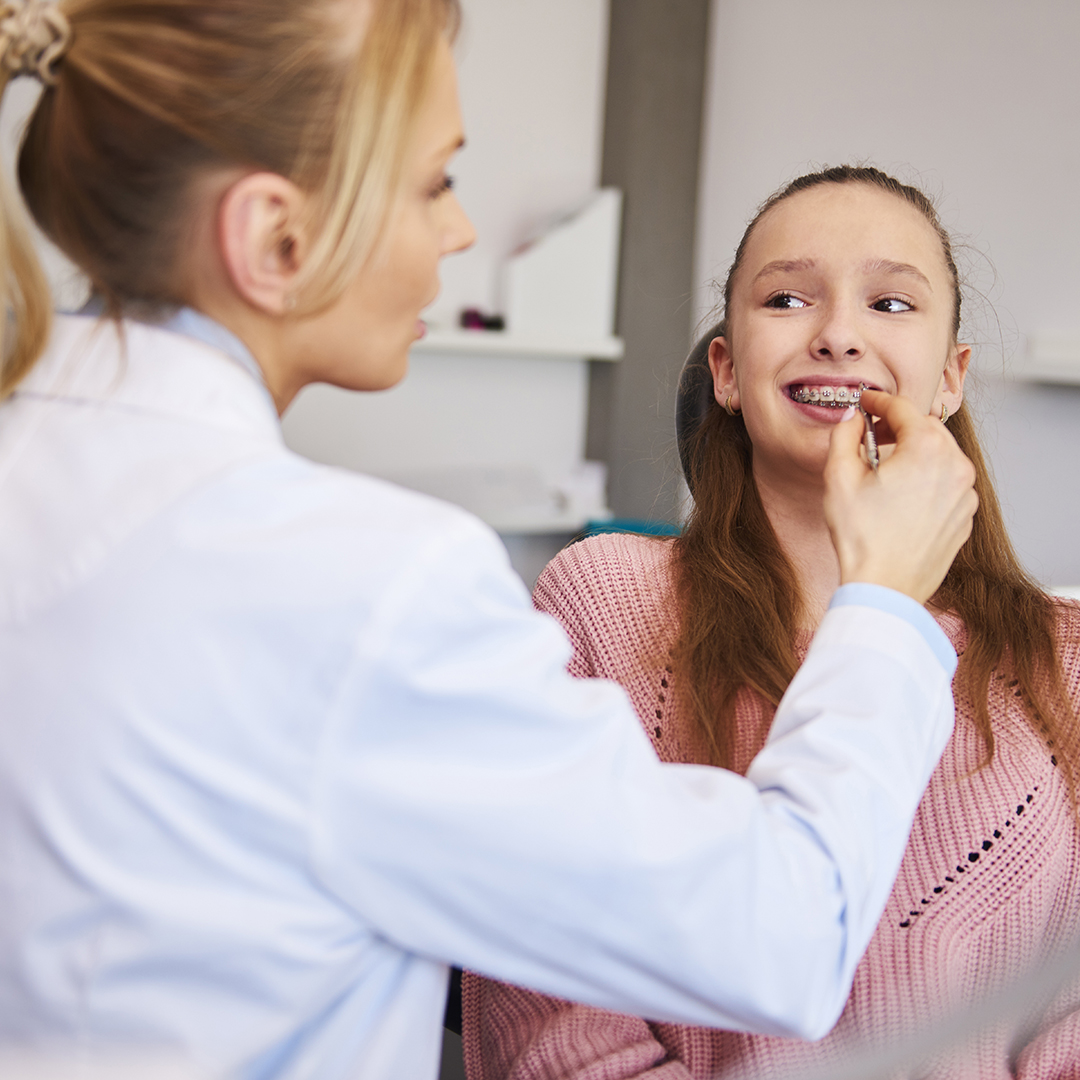 cómo curar las llagas en la boca por brackets