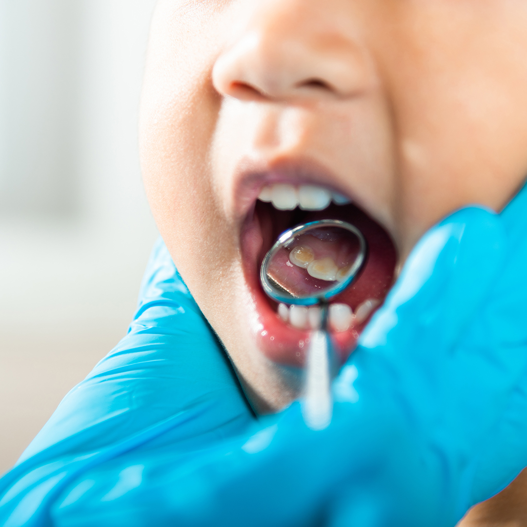 prevención visita dentista