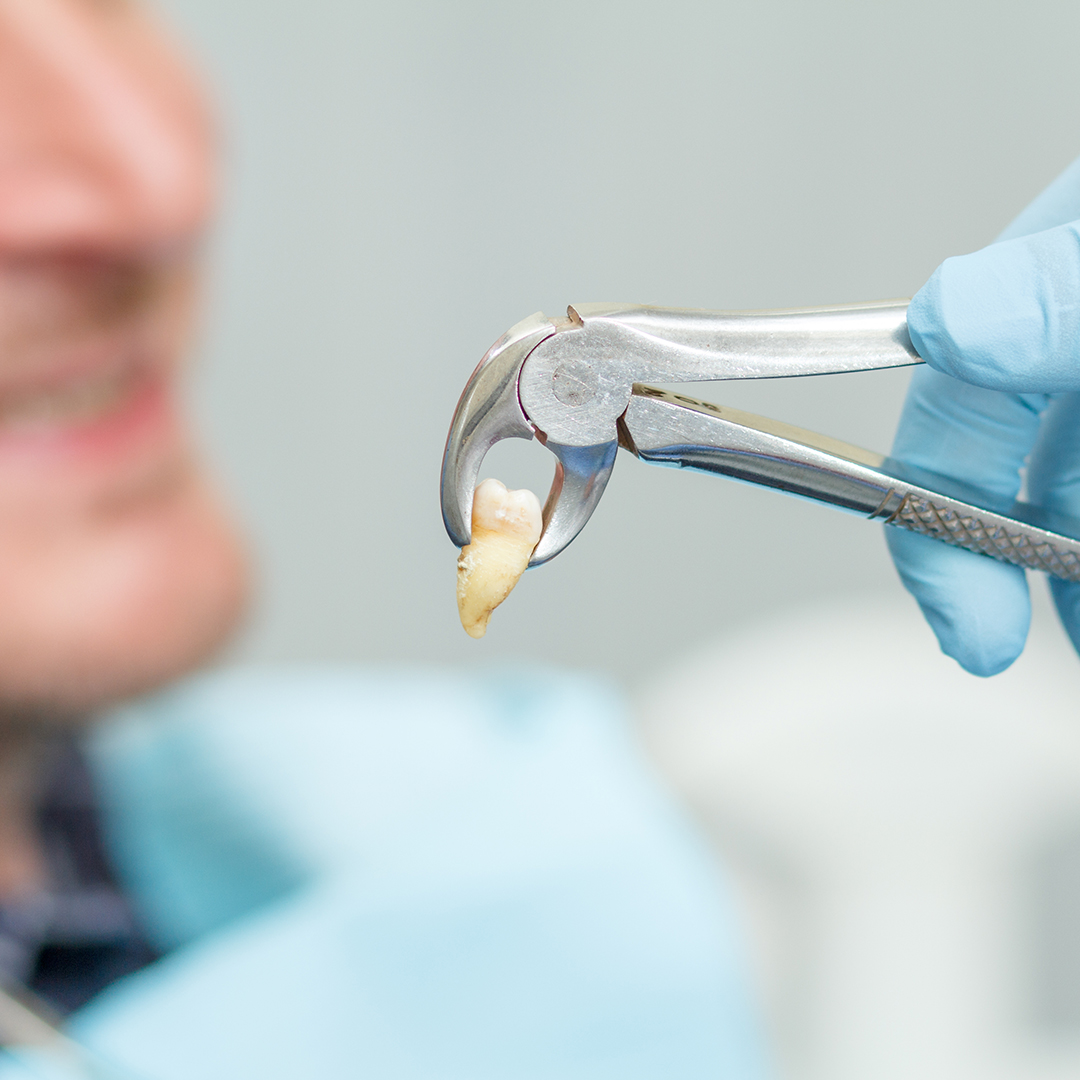 periodontitis