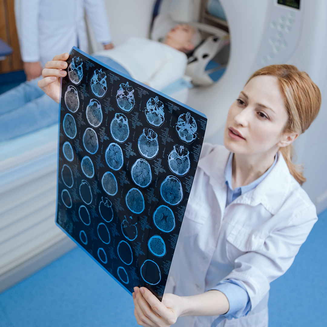 síntomas neurocisticercosis
