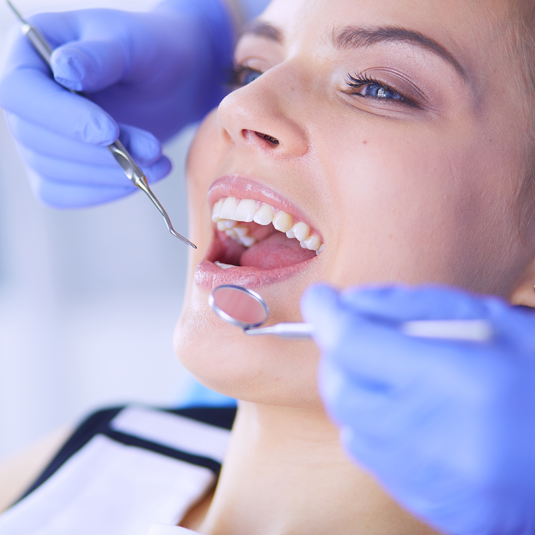 cuidados después de un curetaje dental header