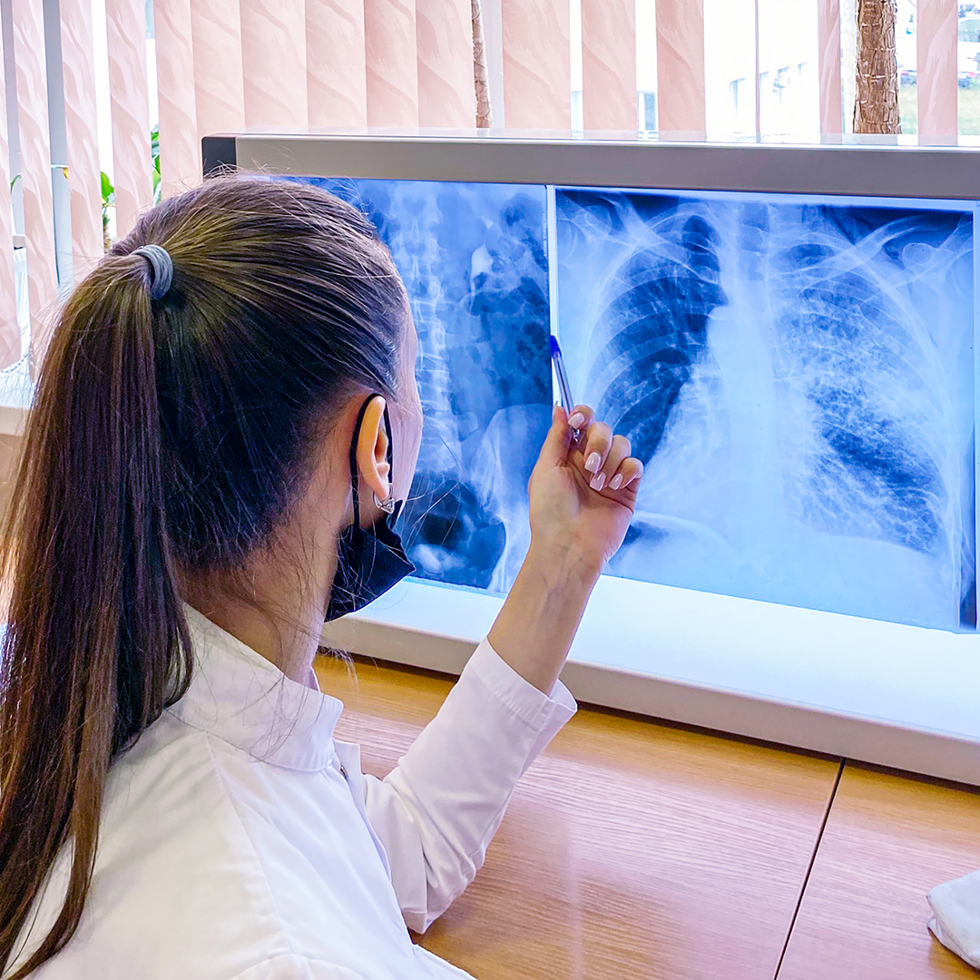 reducir pus facilitar expulsión moco mejorar función pulmonar
