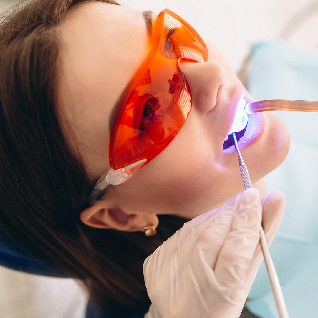 limpieza dental