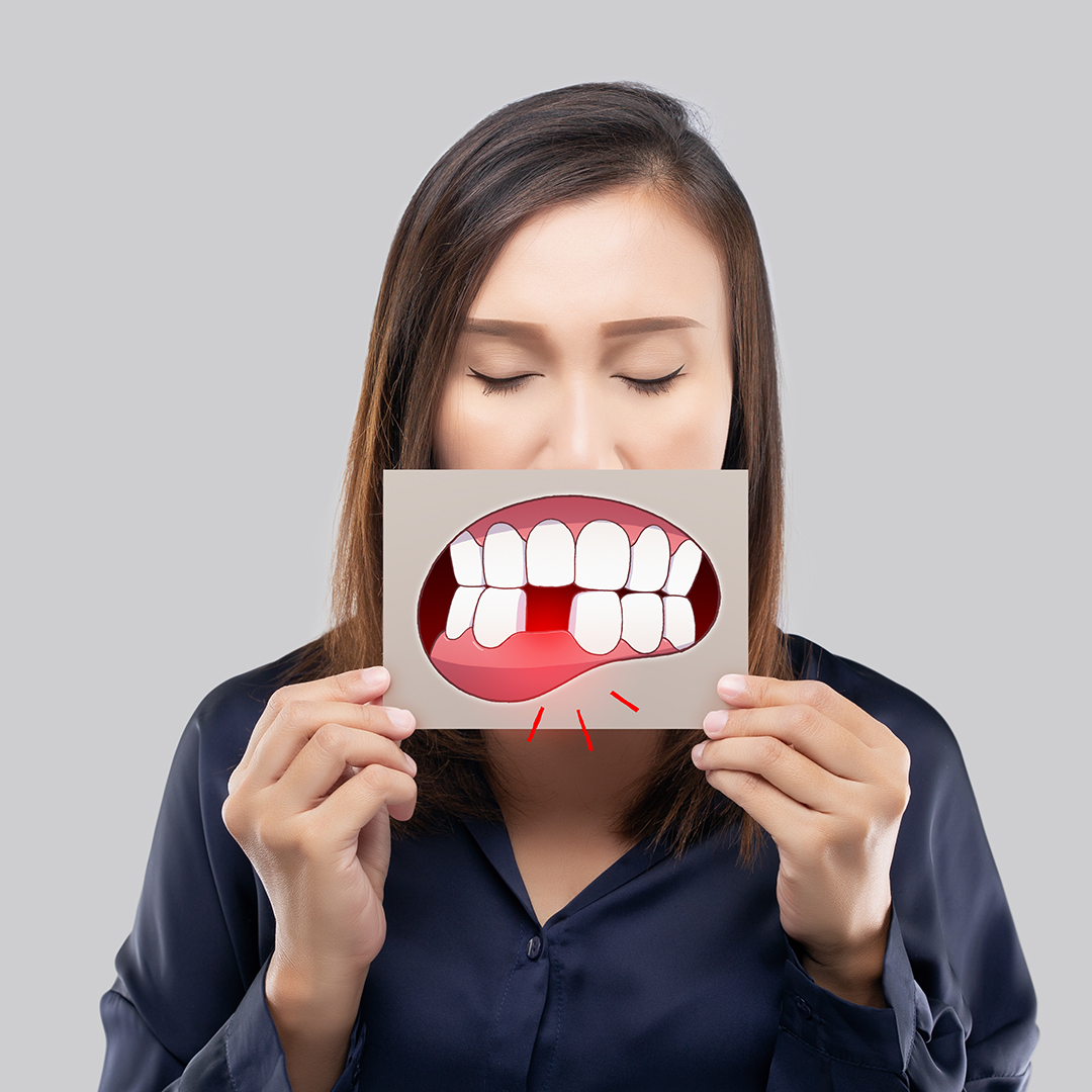 periodontitis