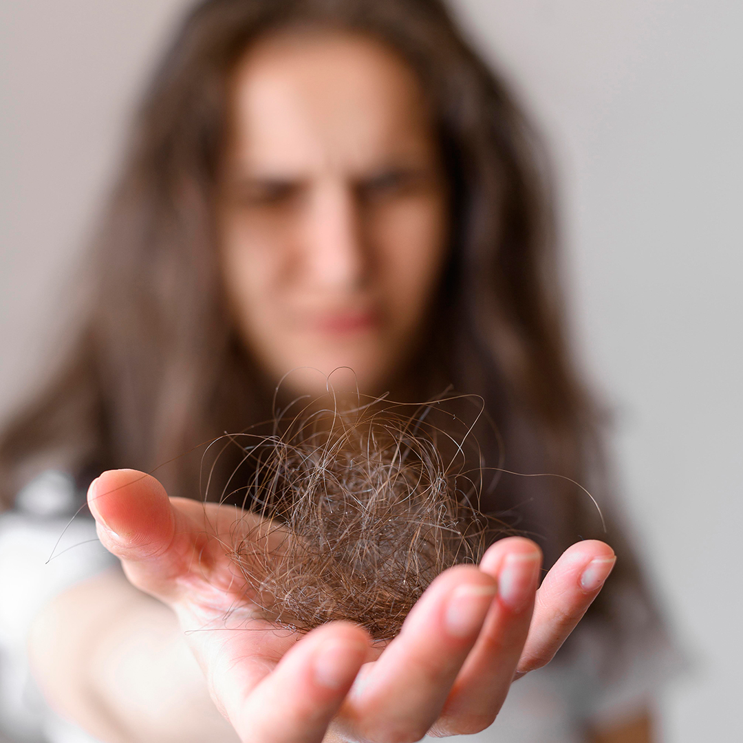 pérdida de cabello